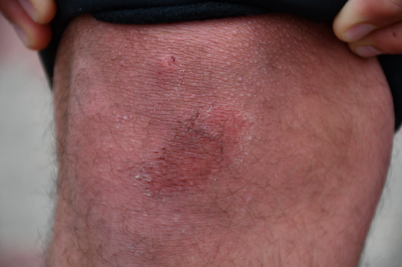 WhatsApp Image 2020-02-23 at 6.12.10 PM.jpeg.jpeg